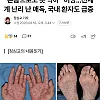"콘돔으로도 못 막아" 전세계 난리